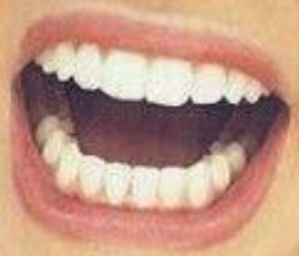 Picture of Daisy Ridley teeth and smile