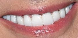 Picture of Demi Moore healthy teeth and smile
