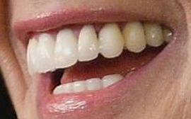 Picture of Demi Moore healthy teeth and smile
