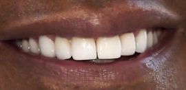 Picture of Denzel Washington teeth and smile