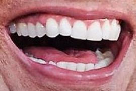 Picture of Dwayne Johnson The Rock's teeth while smiling