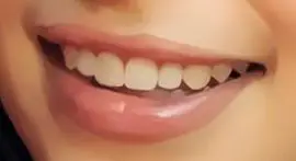 Picture of Emilia Clarke teeth and smile