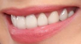 Picture of Emily Blunt teeth and smile