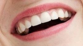 Picture of Emma Stone teeth and smile