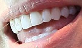 Picture of Erika Jayne teeth and smile