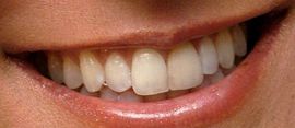 Picture of Eva LaRue teeth and smile