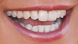 Picture of Eva LaRue teeth and smile
