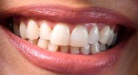 Picture of Eva Longoria teeth and smile