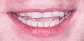 Picture of Ewan McGregor teeth and smile