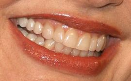 Picture of Geena Davis teeth and smile