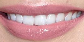 Picture of Gigi Hadid teeth and smile