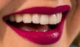 Picture of Gigi Hadid teeth and smile