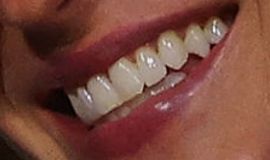 Picture of Gisele Bundchen teeth and smile