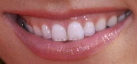 Picture of Giuliana Rancic teeth and smile