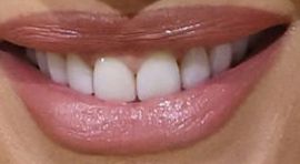Picture of Gwen Stefani's teeth while smiling