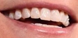 Picture of Gwyneth Paltrow's teeth and smile while smiling