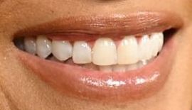 Picture of Halle Berry's teeth and smile