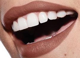 Picture of Halsey teeth and smile