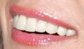 Picture of Helen Hunt teeth and smile