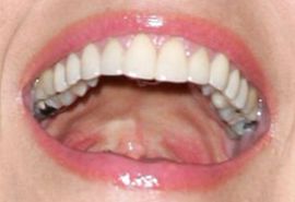Picture of Helen Hunt teeth and smile