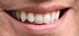 Picture of Henry Cavill teeth and smile