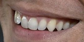 Picture of Henry Cavill teeth and smile
