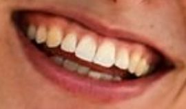 Picture of Iga Swiatek teeth and smile