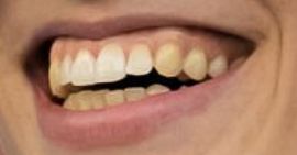 Picture of Iga Swiatek teeth and smile