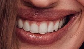 Picture of Irina Shayk teeth and smile