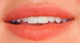 Picture of Isabel May teeth and smile
