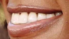 Picture of Issa Rae teeth and smile