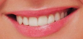 Picture of Izabella Scorupco teeth and smile