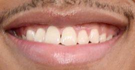 Picture of Jabari Banks teeth and smile
