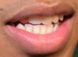 Picture of Jabari Banks teeth and smile