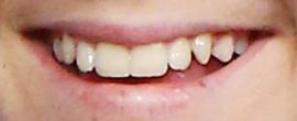 Picture of Jack Dylan Grazer teeth and smile