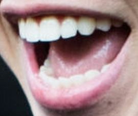 Picture of Jacob Sartorius teeth and smile
