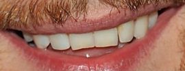 Picture of James McAvoy teeth and smile