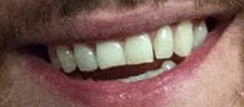 Picture of James McAvoy teeth and smile