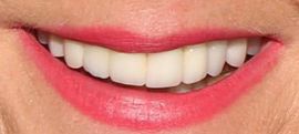 Picture of Jane Krakowski teeth and smile