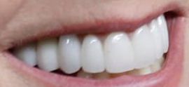 Picture of Jane Krakowski teeth and smile