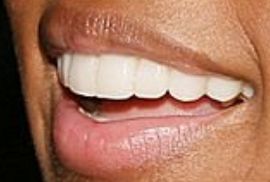 Picture of Janelle Monae teeth and smile