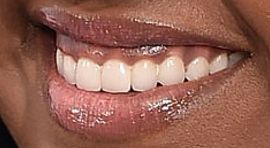 Picture of Jazmine Sullivan teeth and smile