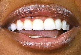 Picture of Jazmine Sullivan teeth and smile