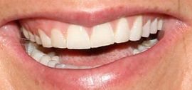 Picture of Jenna Bush Hager teeth and smile