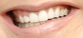 Picture of Jenna Bush Hager teeth and smile