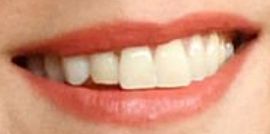 Picture of Jennifer Connelly teeth and smile