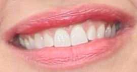 Picture of Jennifer Garner teeth and smile