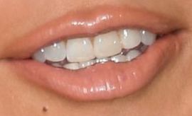 Jennifer Lopez's teeth and smile