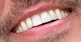 Picture of Jesse Palmer teeth and smile