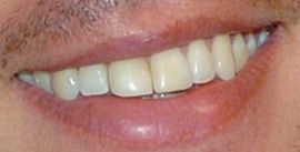 Picture of Jesse Palmer teeth and smile